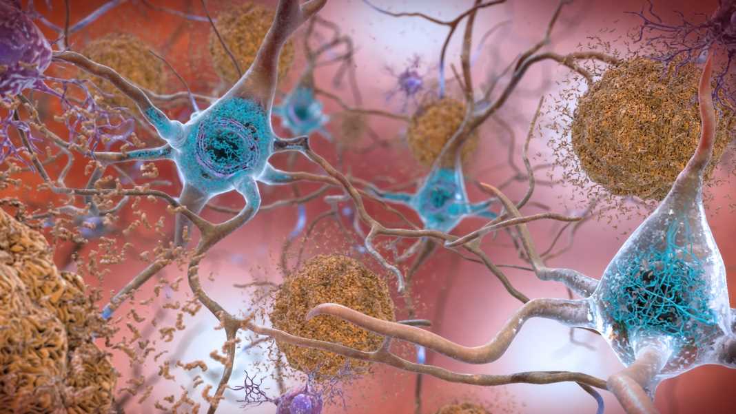 Revolutionizing Alzheimer's Disease Treatment with GPT-3-Based Apps